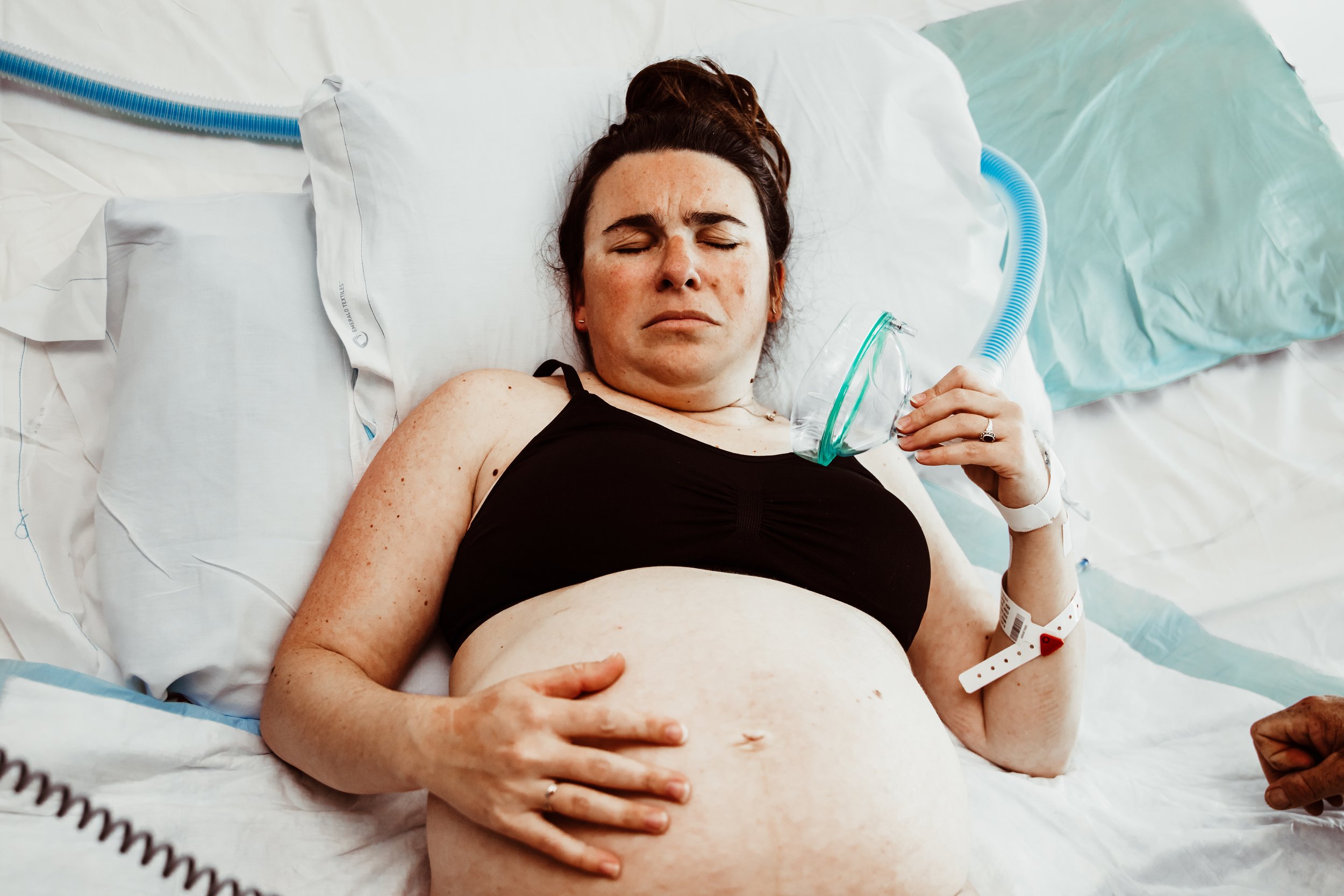 A laboring woman lying in a hospital bed, holding a nitrous mask in her hand, with a fetal monitor band on her wrist, and a nasal oxygen tube. Jacksonville, Florida.