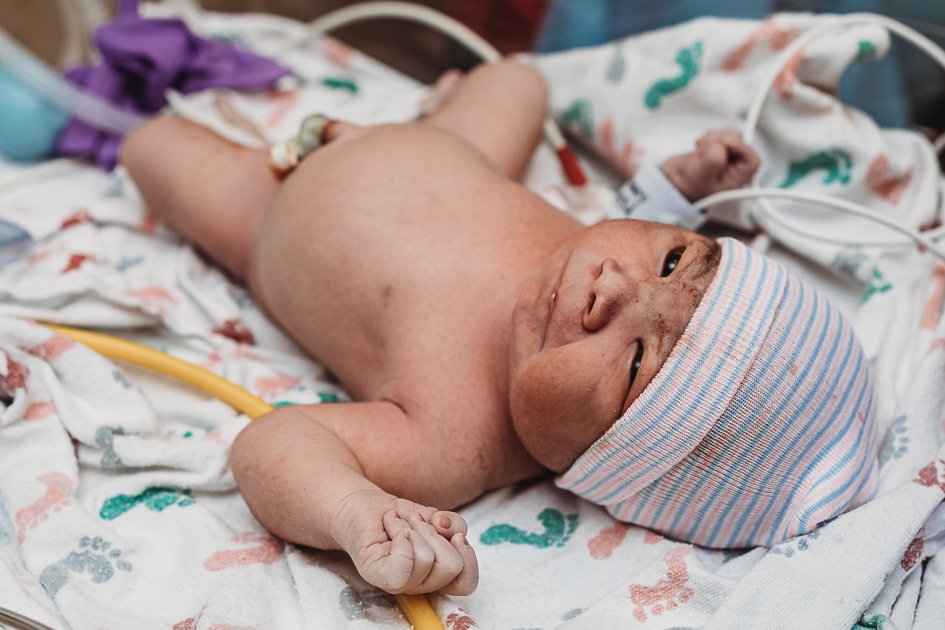 Newborn baby lying on hospital bed wearing a striped cap, surrounded by medical equipment and blankets.
