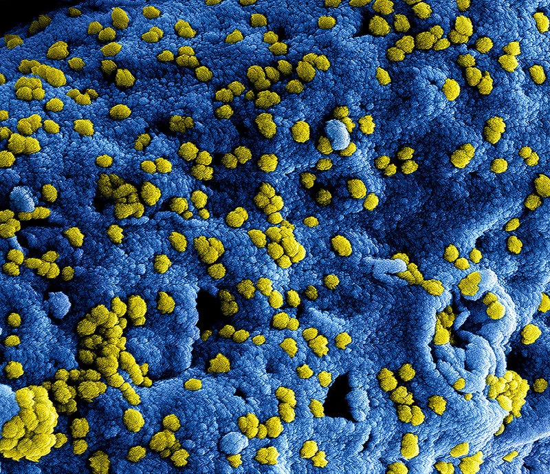 Herbs and virology: A primer on Viruses and Herbal Medicine