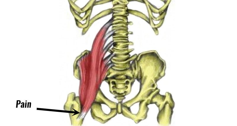 Common pain of the hip can be due to the Iliopsoas. Show Up Fitness and our great partners the Prehab guys will help you fix this and more when attending Show Up Fitness Internship