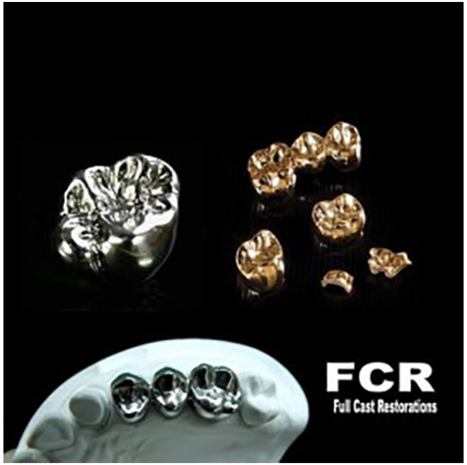Crown And Bridge Procedure Full Cast Restoration Dental Technology Studio 2