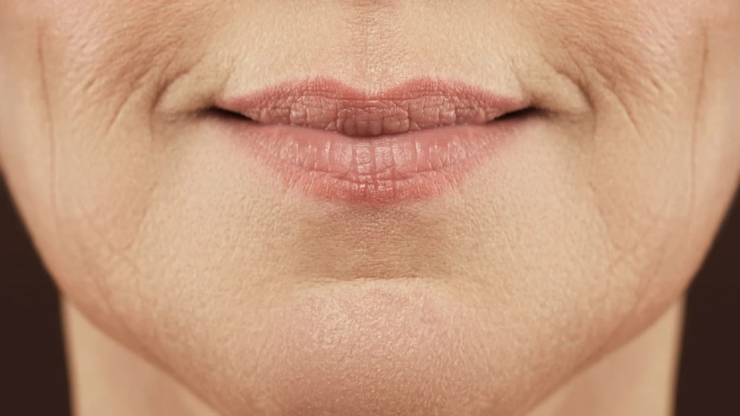 Image of jowl reduction before treatment