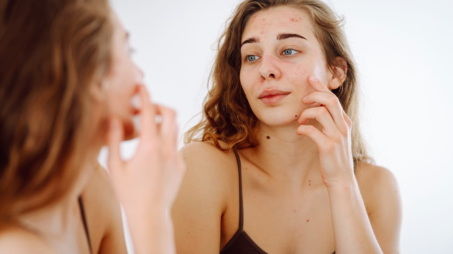Common skin concerns