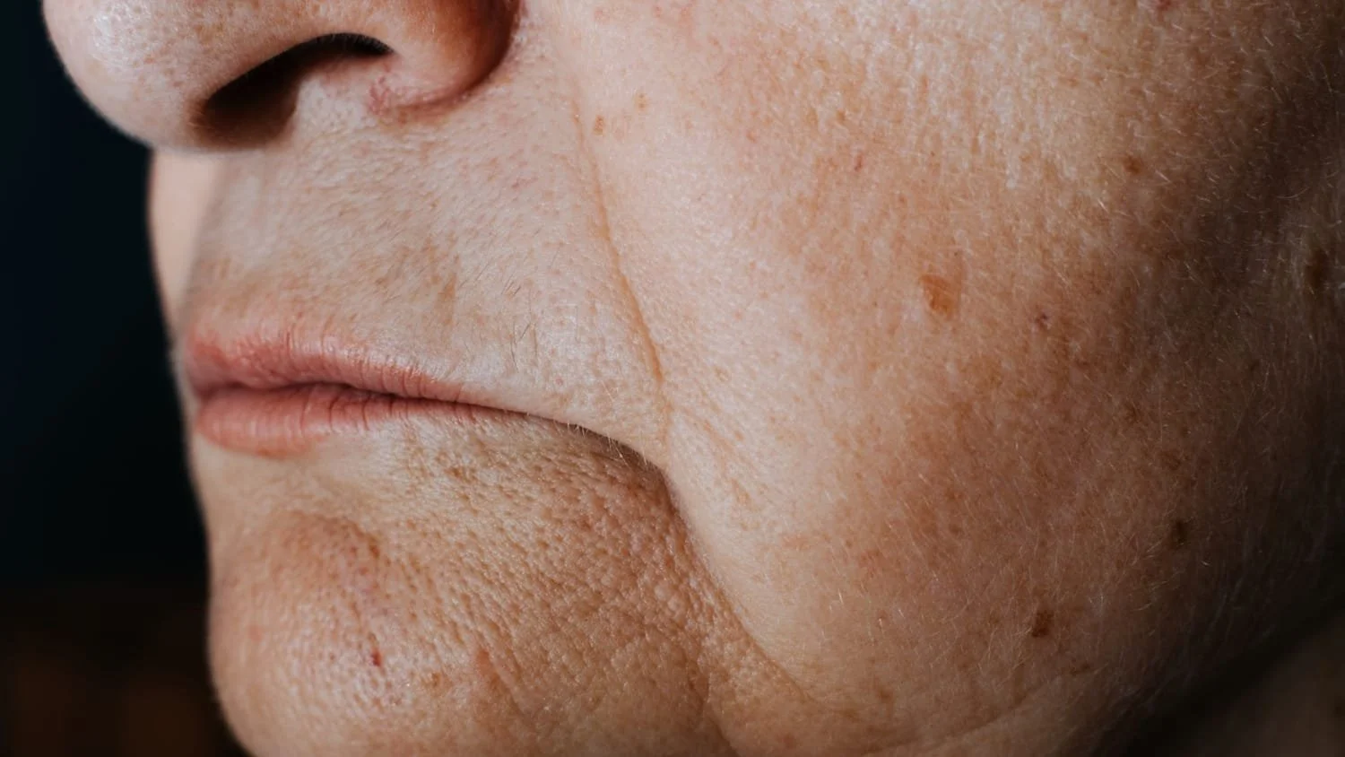 Mature woman with sagging skin around the jawline