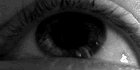 Episode 7: Nystagmus