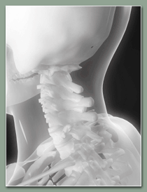 neck-pain.gif