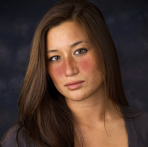 rosacea.png