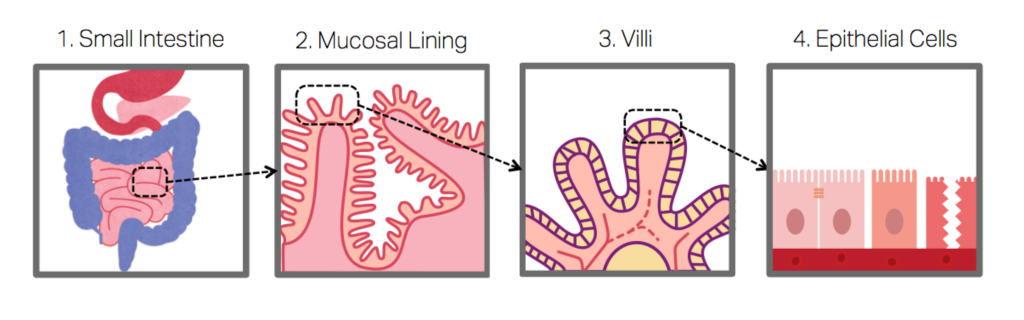 Anatomy of a Leaky Gut