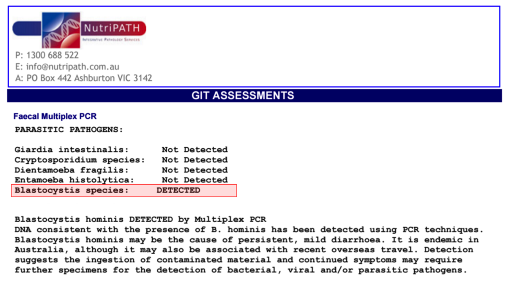 How to Test for IBS Root Causes