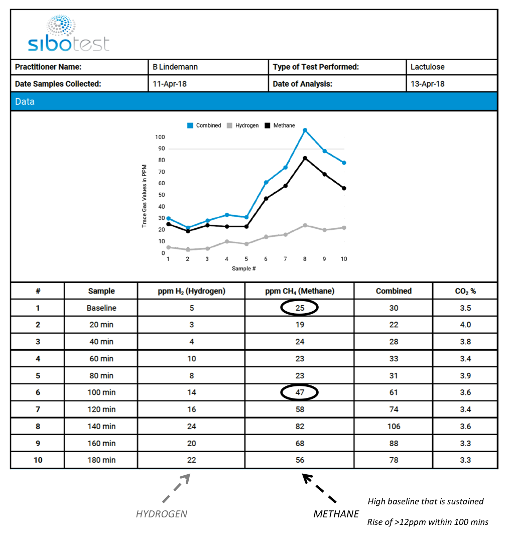 Constipation Methane SIBO Test