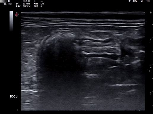 February's Case of the Month - 2023