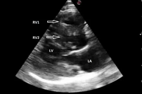 March's Case of the Month - 2023