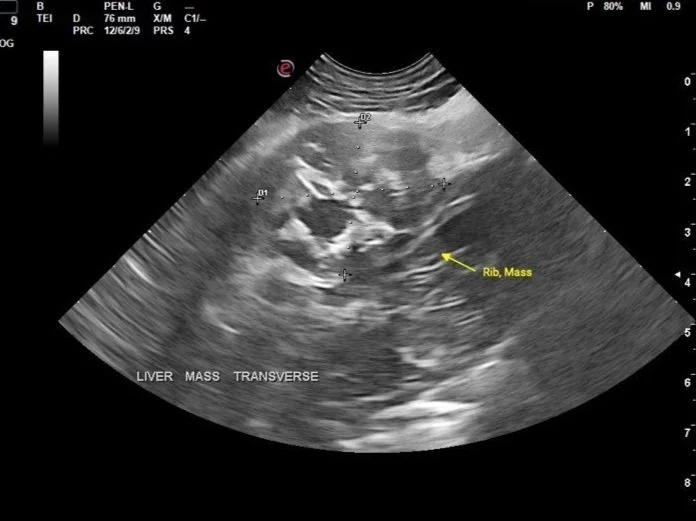 May's Case of the Month - 2023