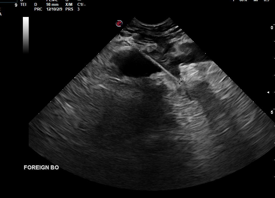 July's Case of the Month - 2023