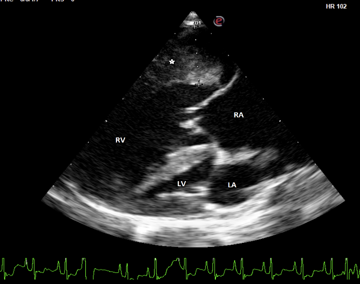 August's Case of the Month - 2023