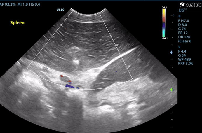January's Case of the Month-2024