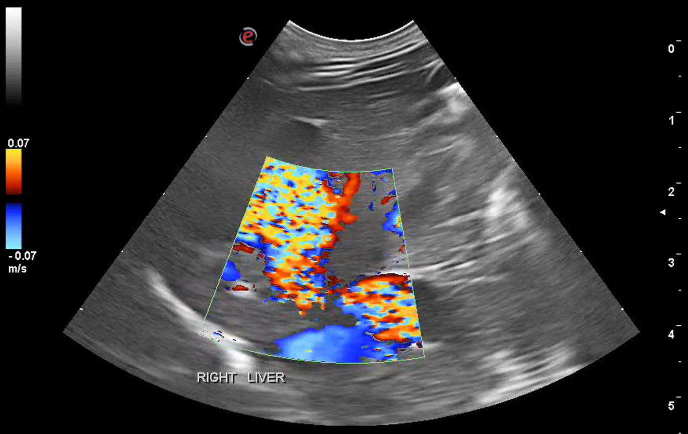 February's Case of the Month- 2024