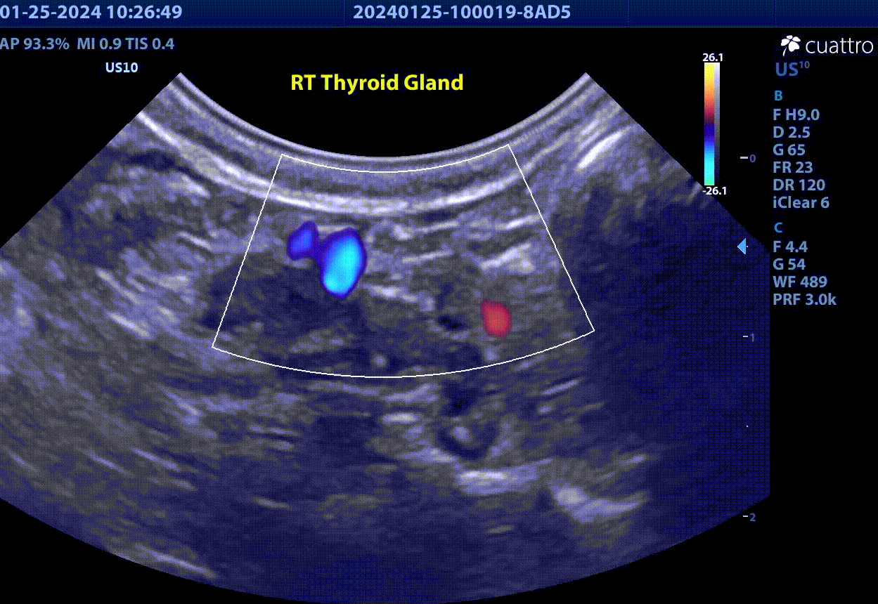 March’s Case of the Month - 2024