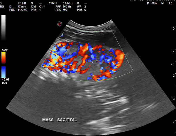 Thyroid Carcinoma in a Canine