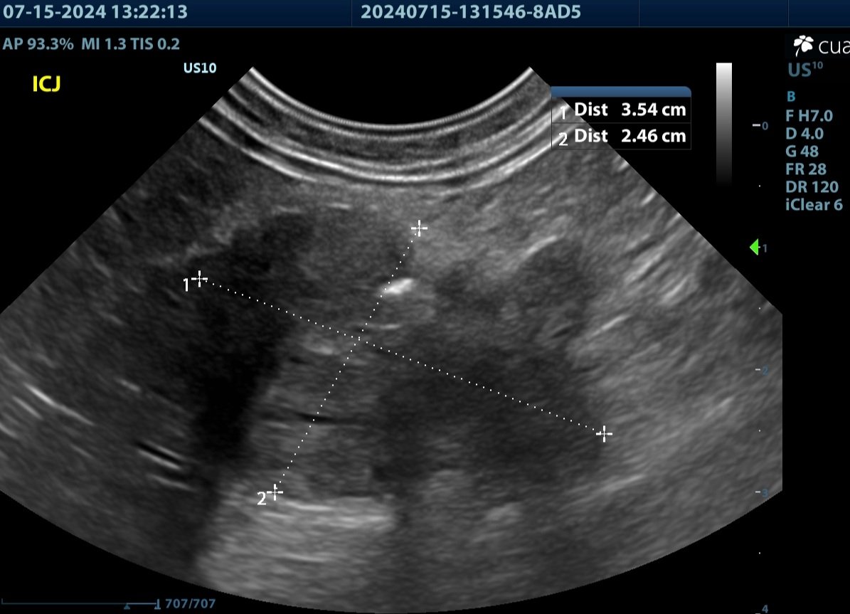 Suspected Carcinomatosis in a Feline