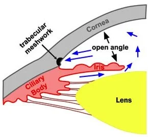 glaucoma_treatment_1