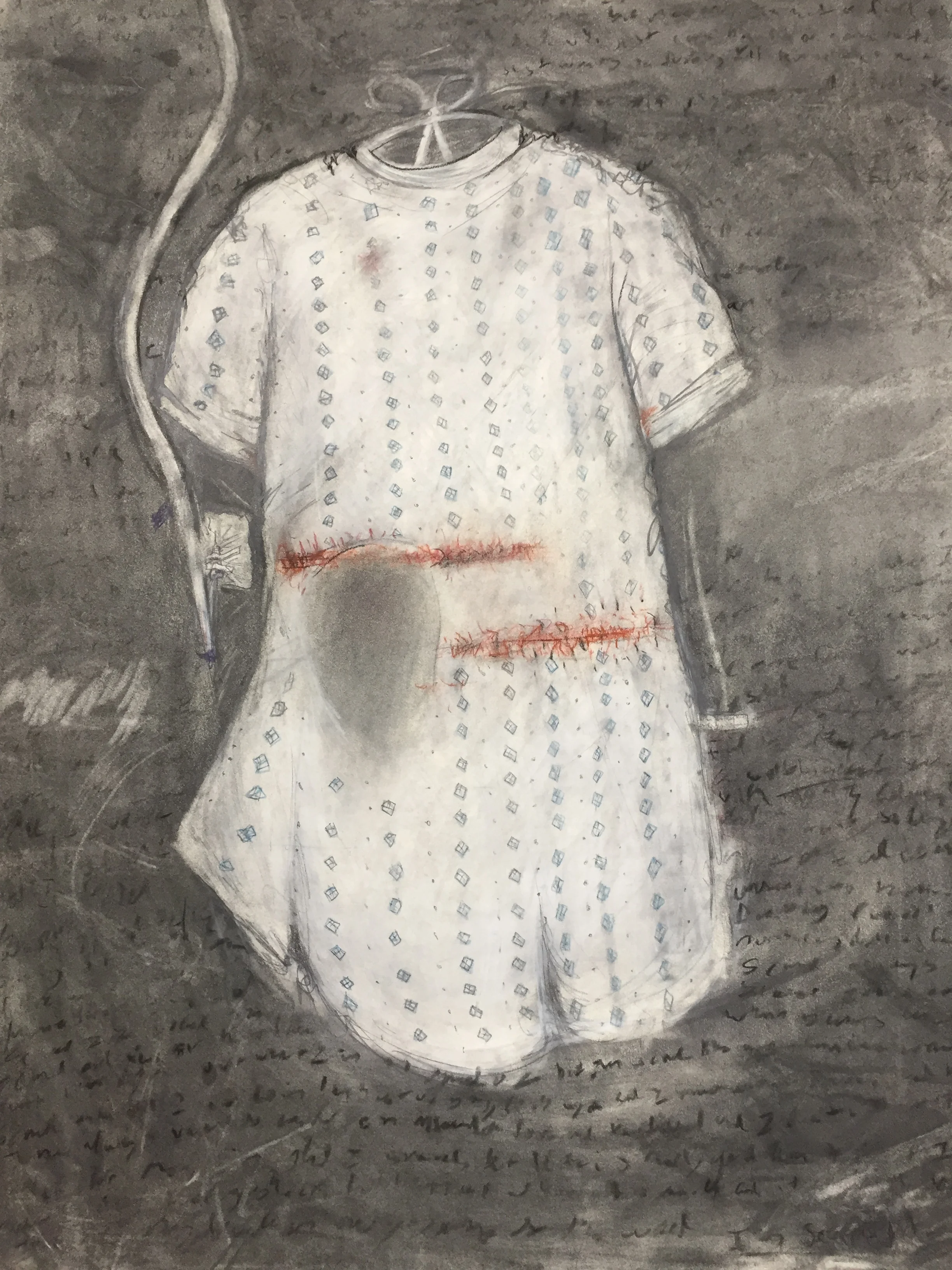 Self-Portrait as My Childhood Hospital Gown