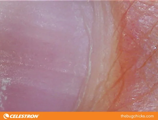 Gross Anatomy — The Bug Chicks