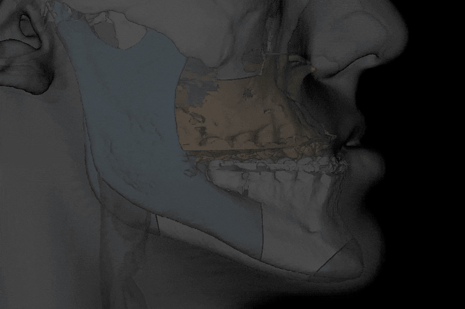 gif1.gif