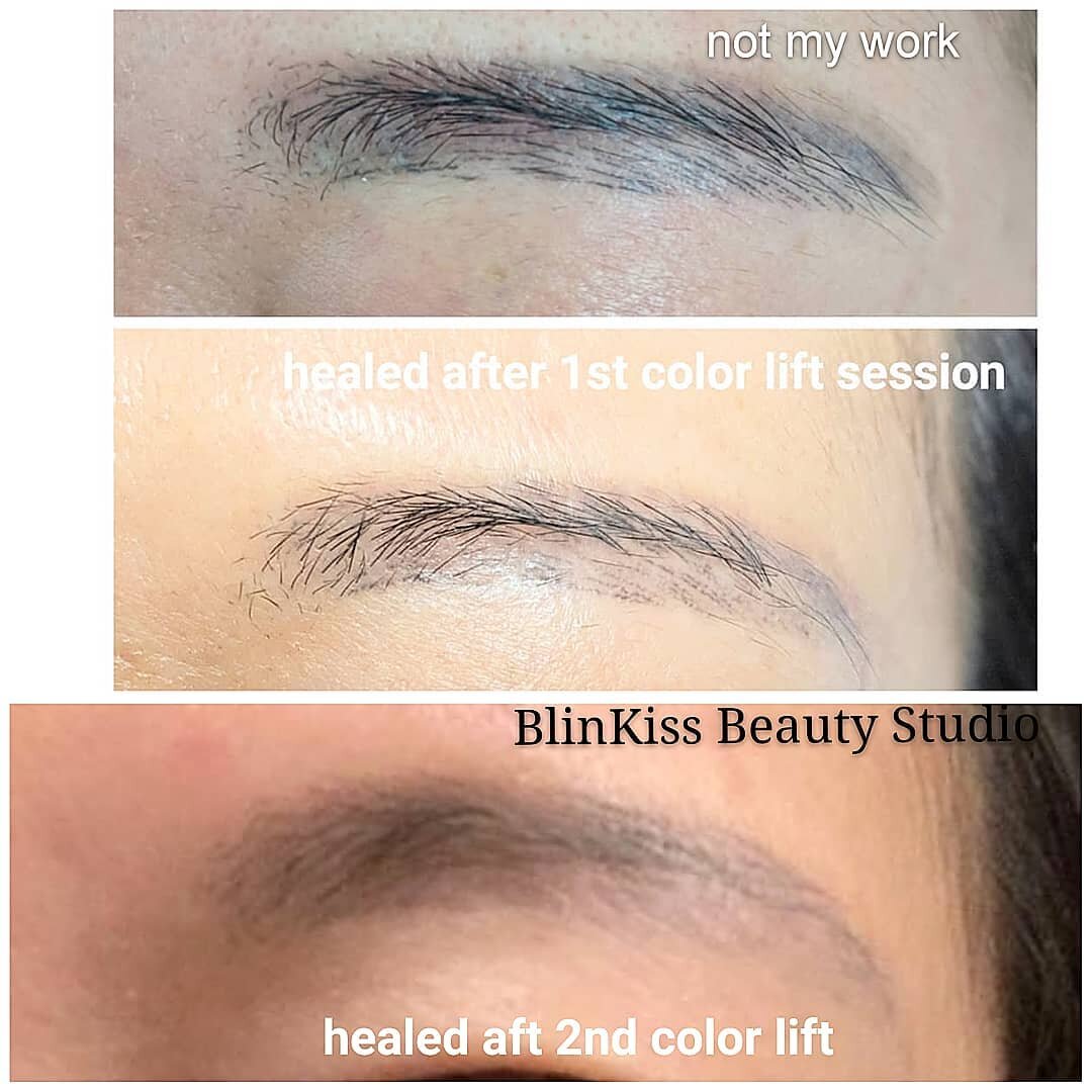 Saline Removal — BlinKiss Beauty Studio