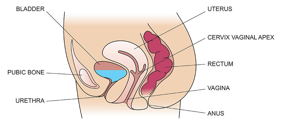 A Guide to Pelvic-Organ Prolapse: What is it? What are my