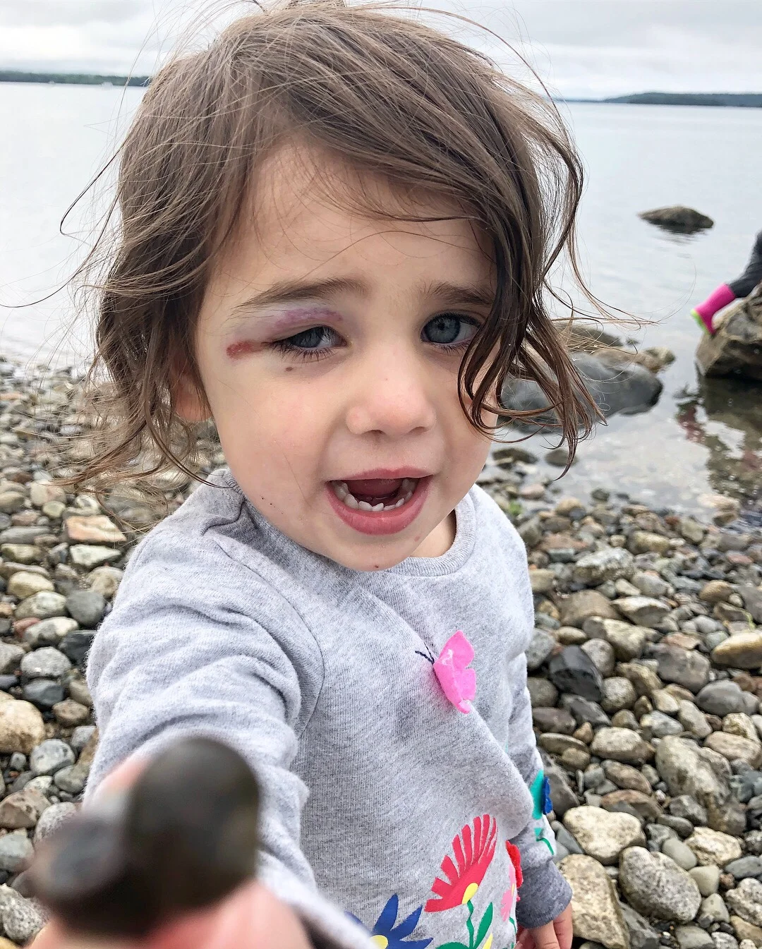 Check out Rocky Balboa here after she ran into her bedpost the first night! “Cut me Mick!”