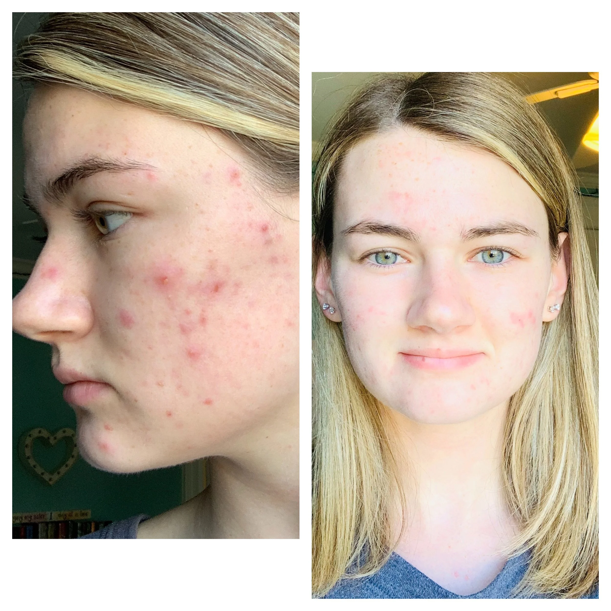  Processed with MOLDIV 