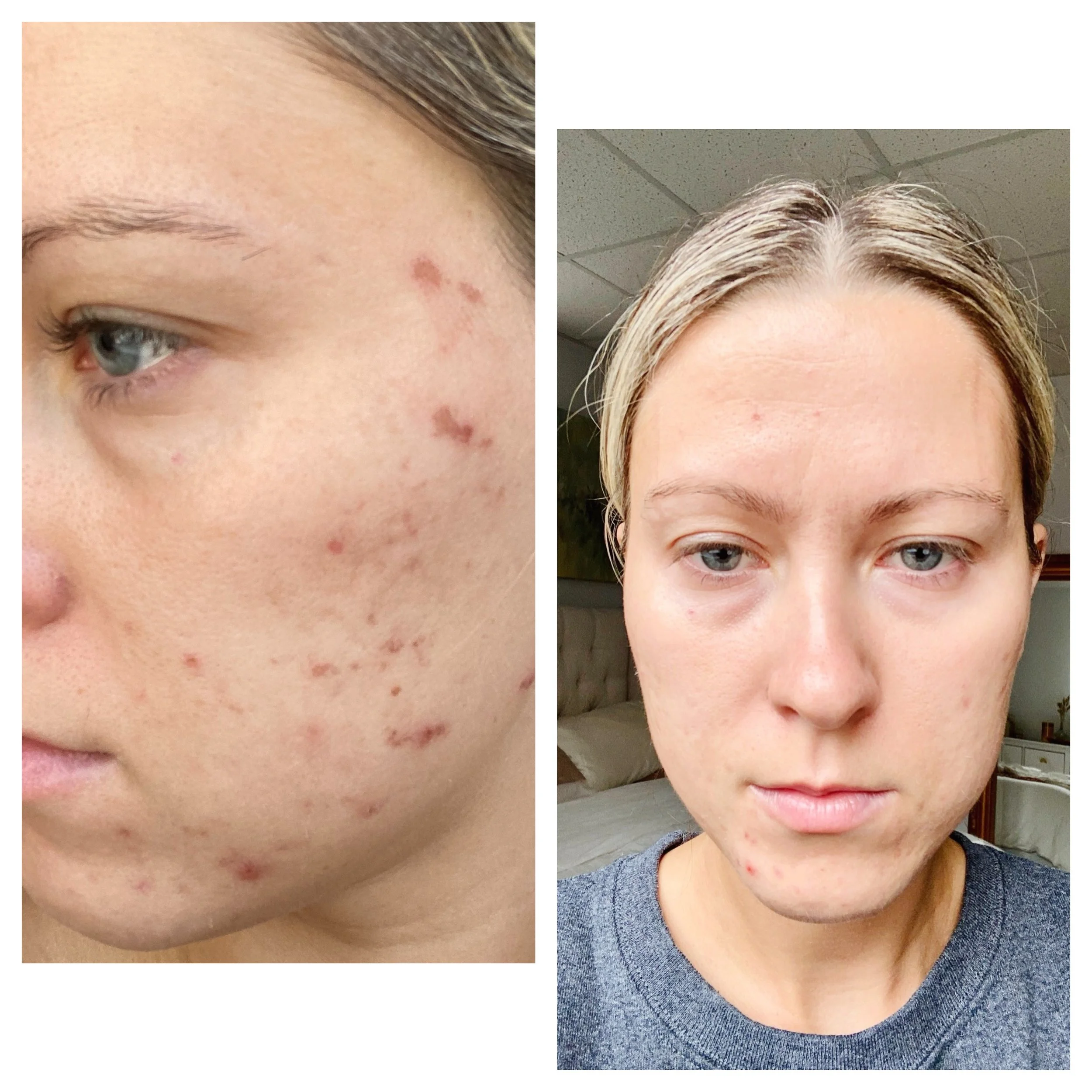  Processed with MOLDIV 