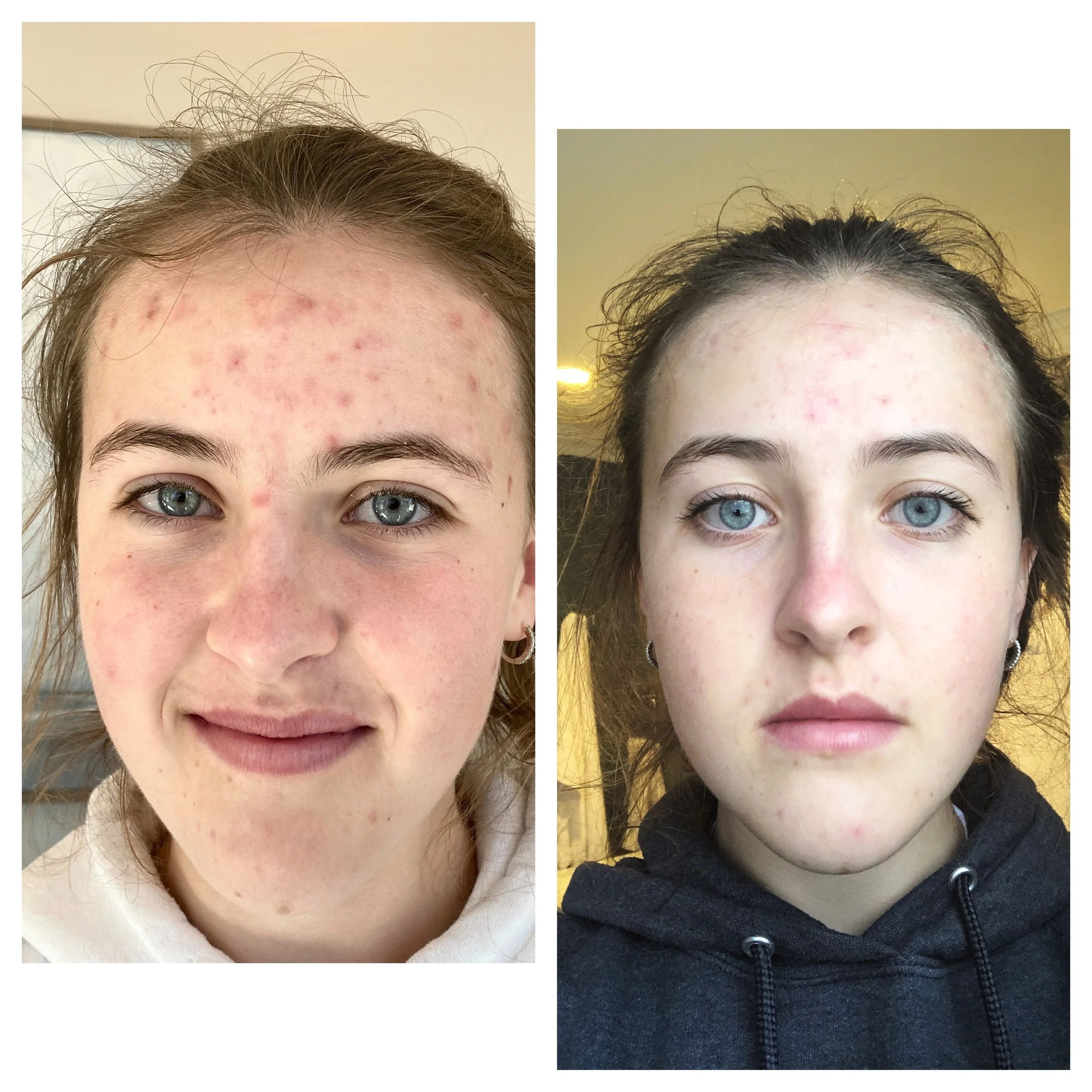  Processed with MOLDIV 