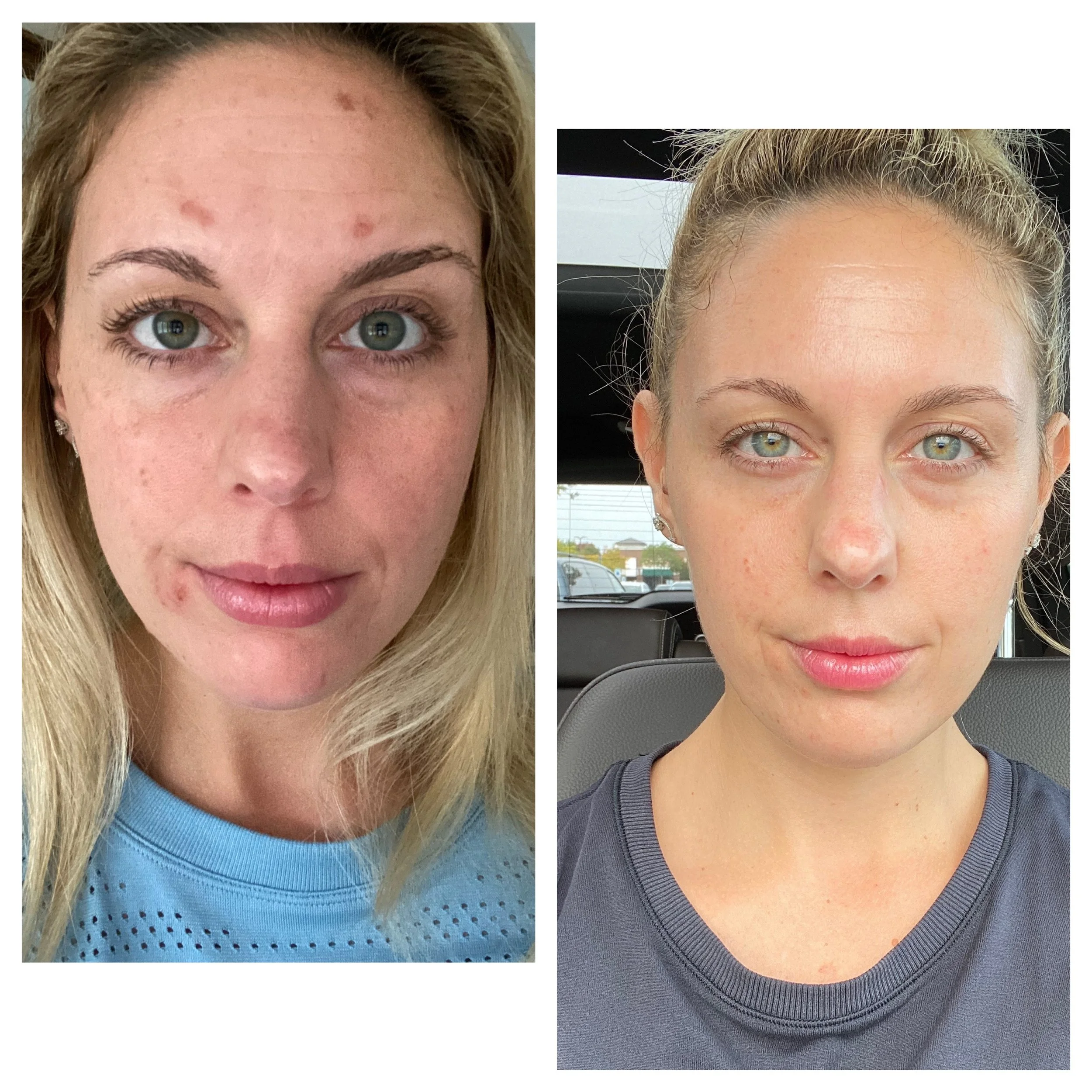  Processed with MOLDIV 