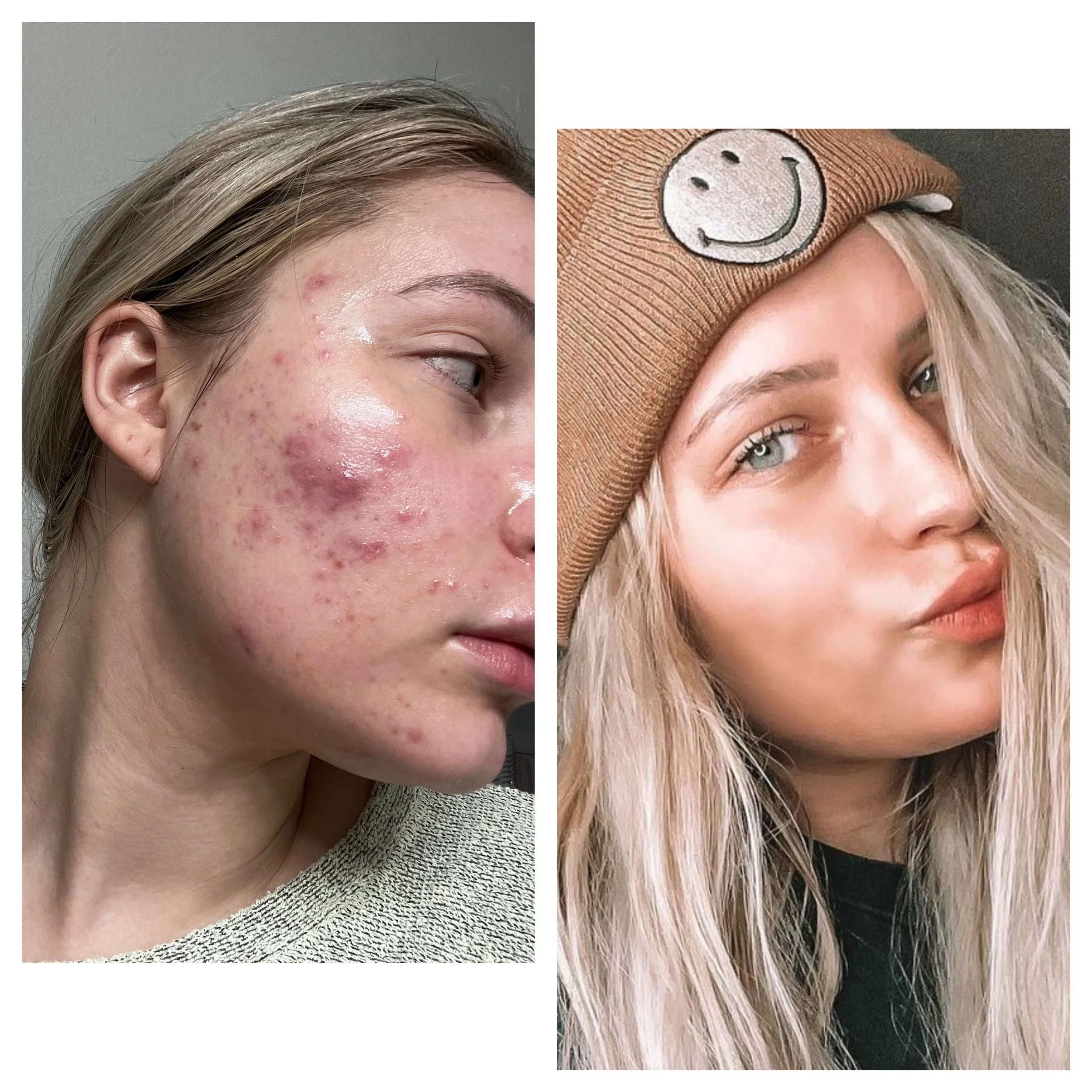  Processed with MOLDIV 