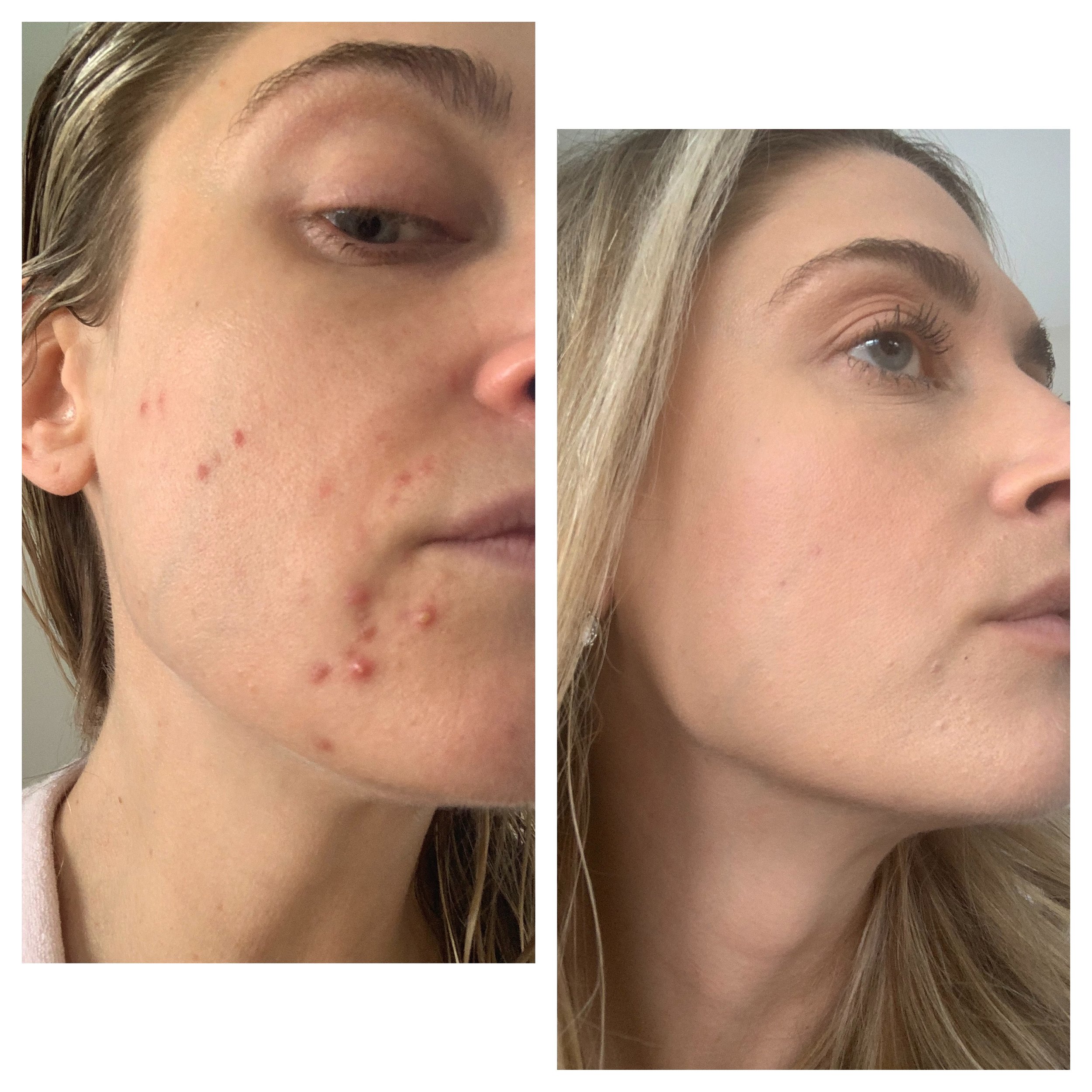  Processed with MOLDIV 