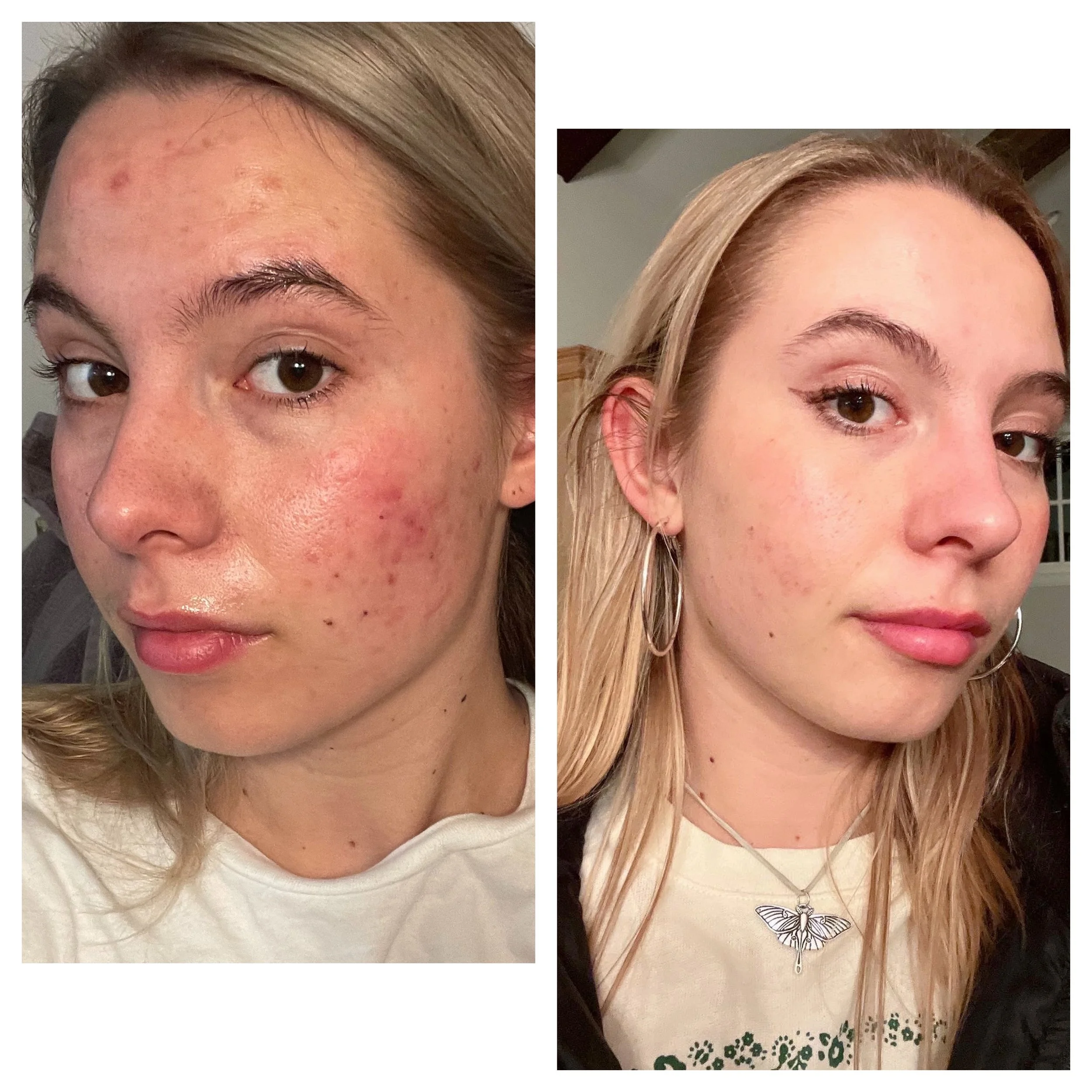  Processed with MOLDIV 