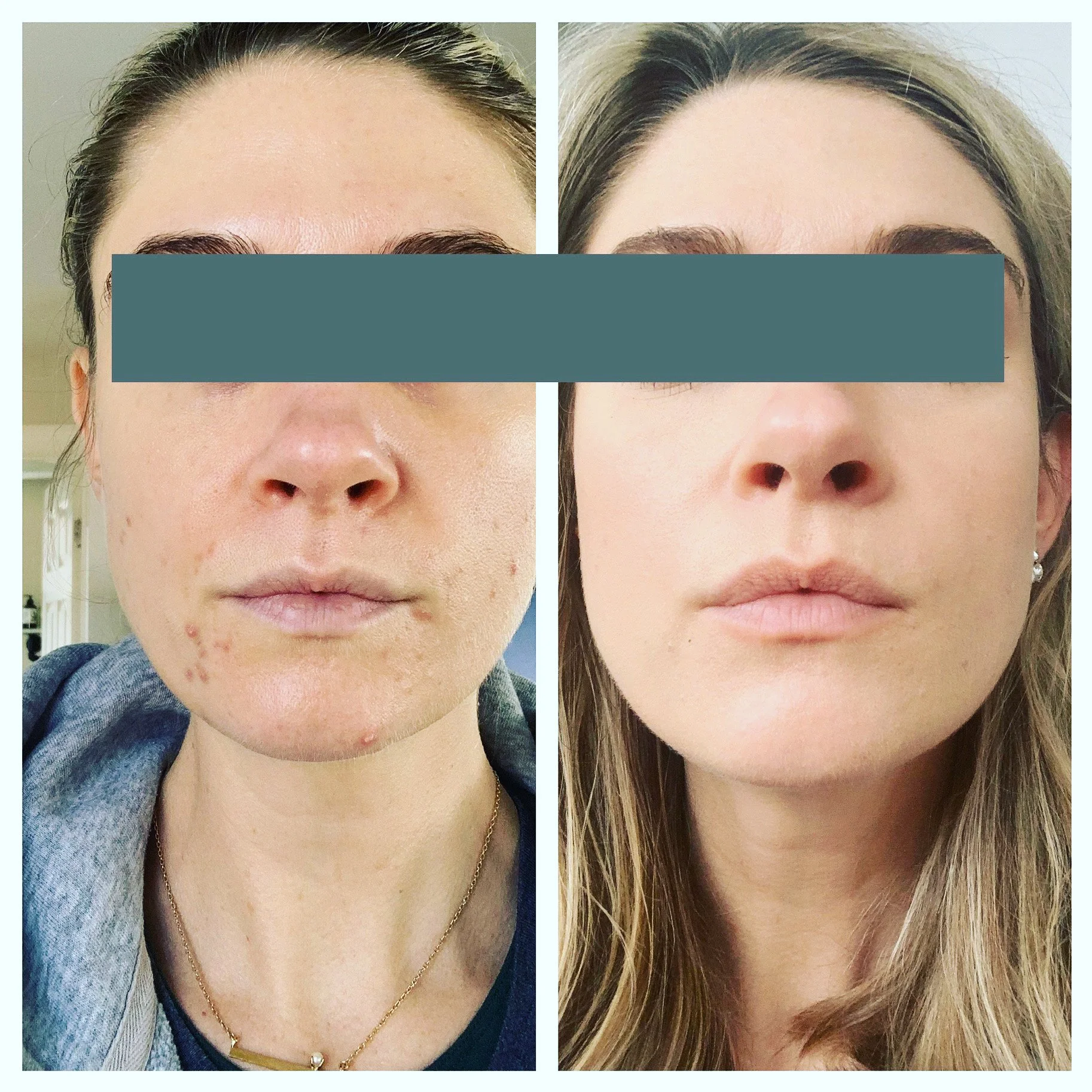  Processed with MOLDIV 