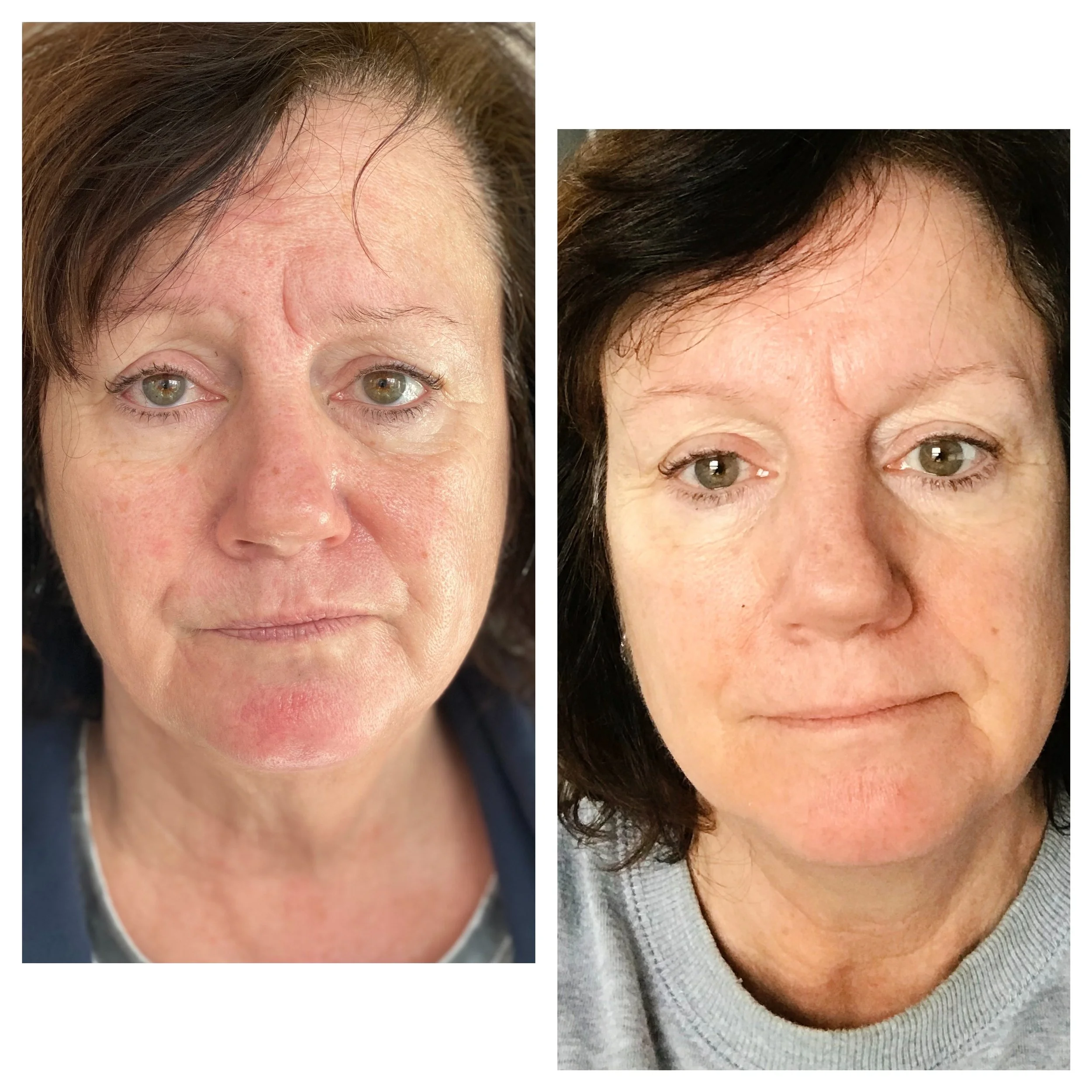  Processed with MOLDIV 