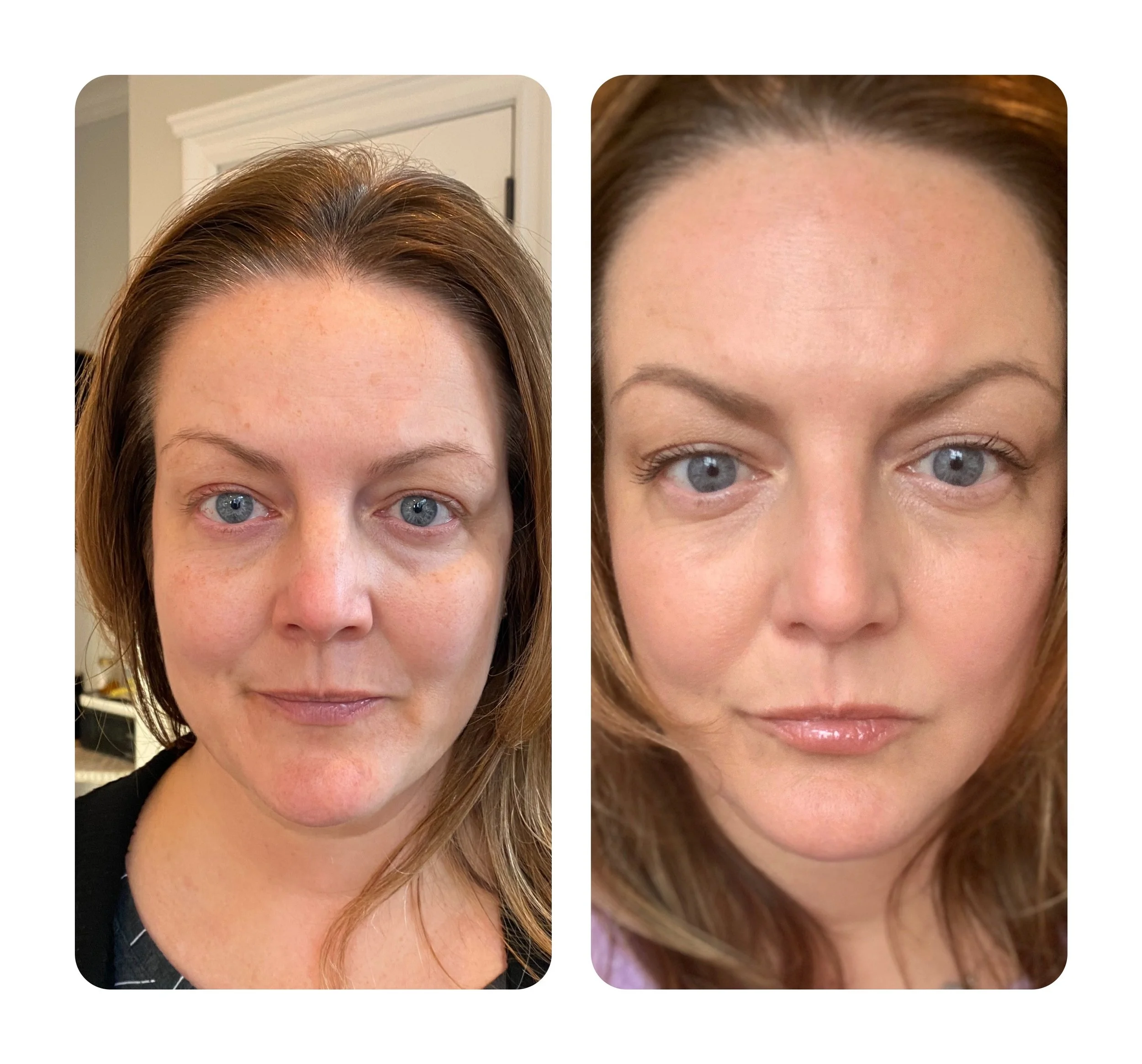  Processed with MOLDIV 