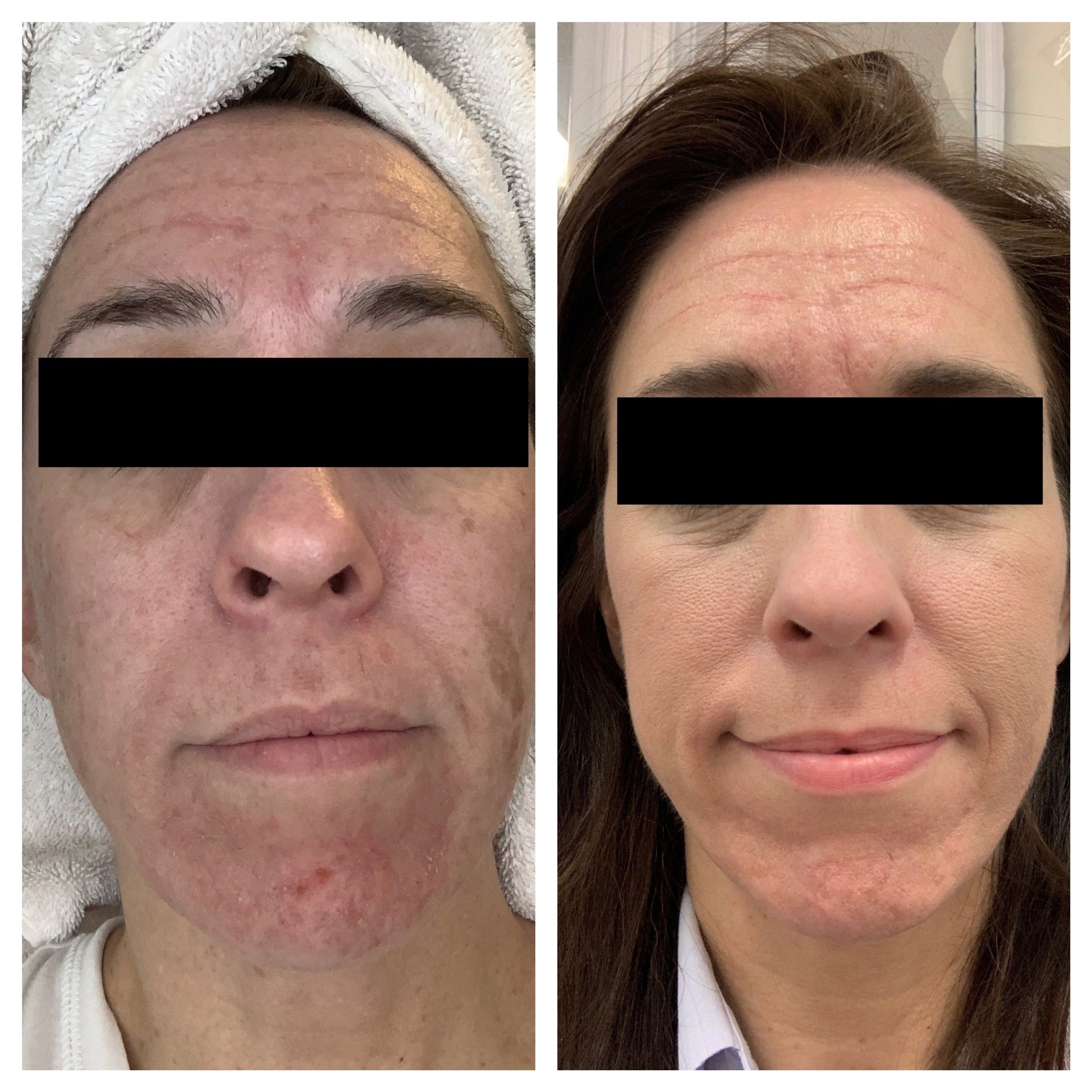  Processed with MOLDIV 