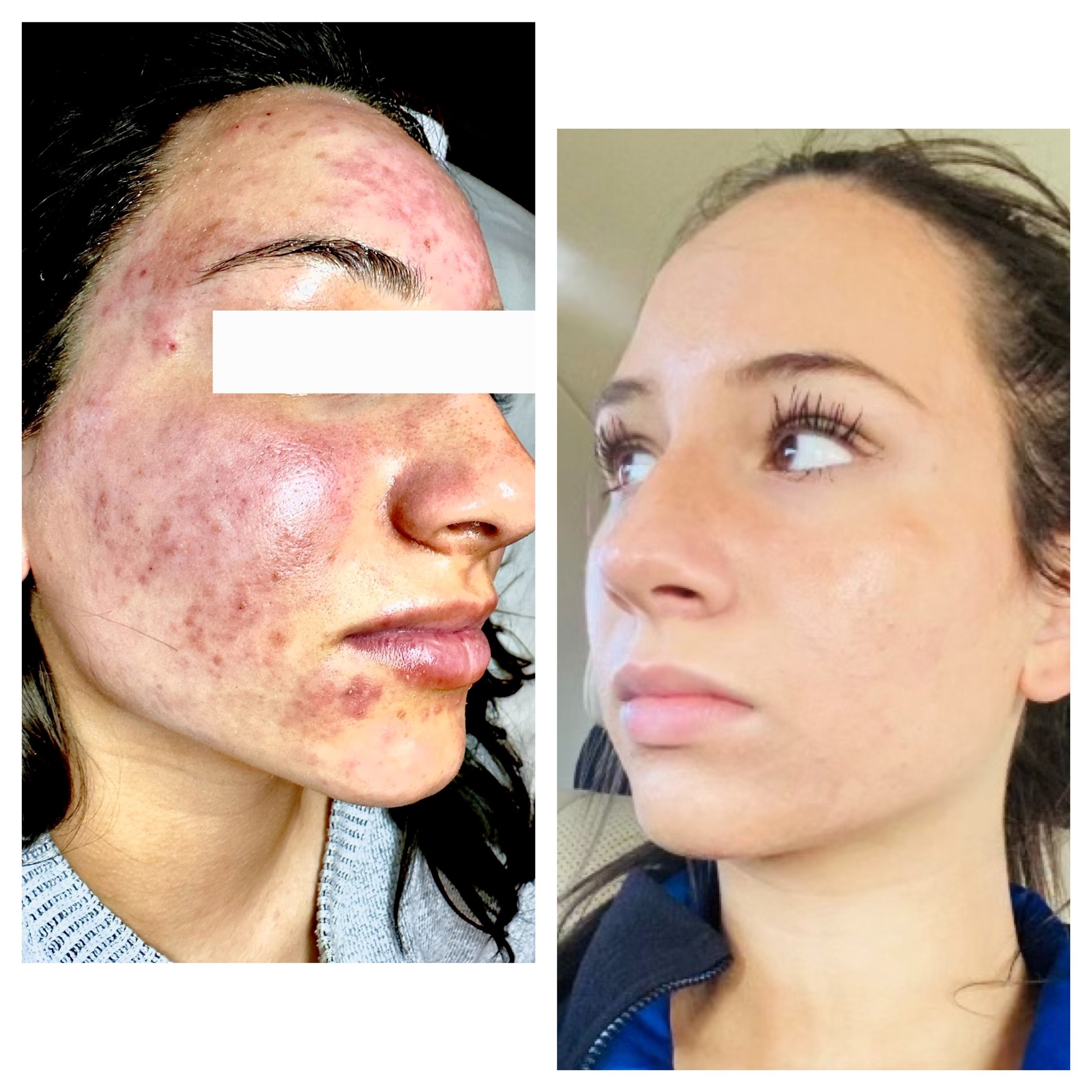  Processed with MOLDIV 