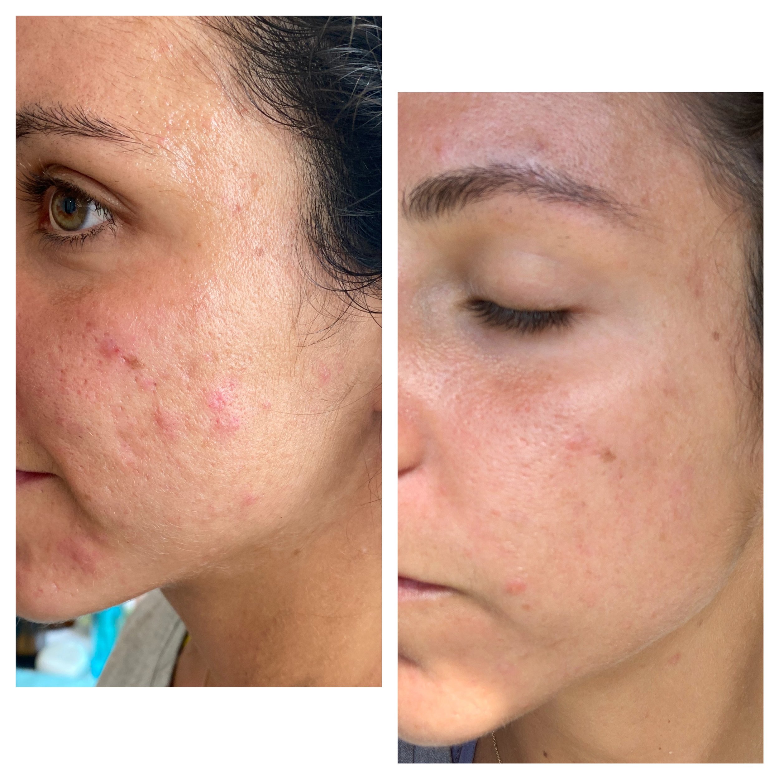  Processed with MOLDIV 