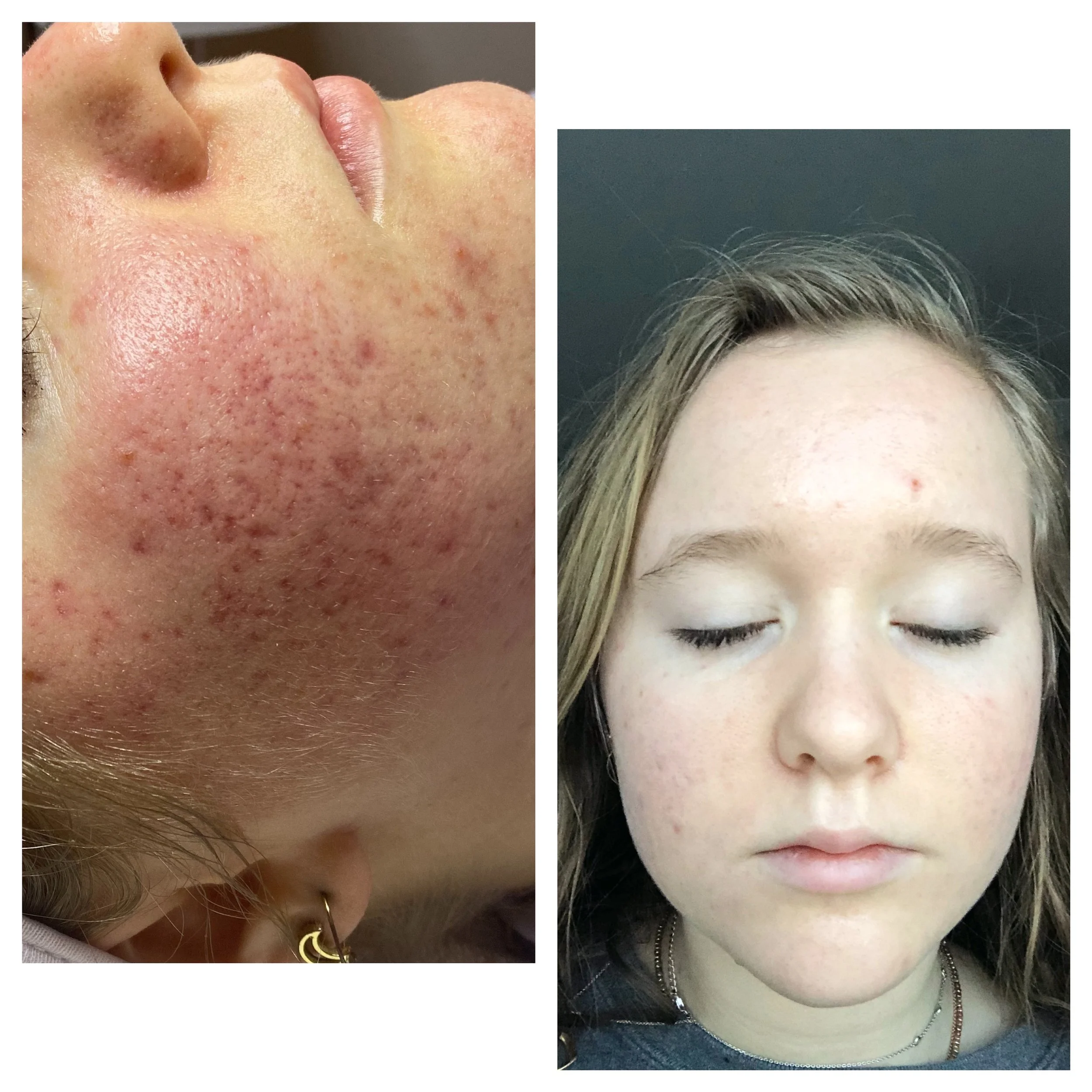  Processed with MOLDIV 