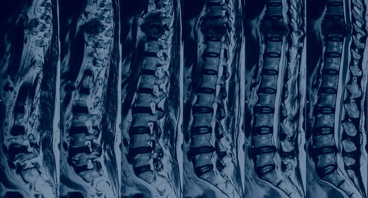 Things You Should Know About Bone Strength and Spinal Health