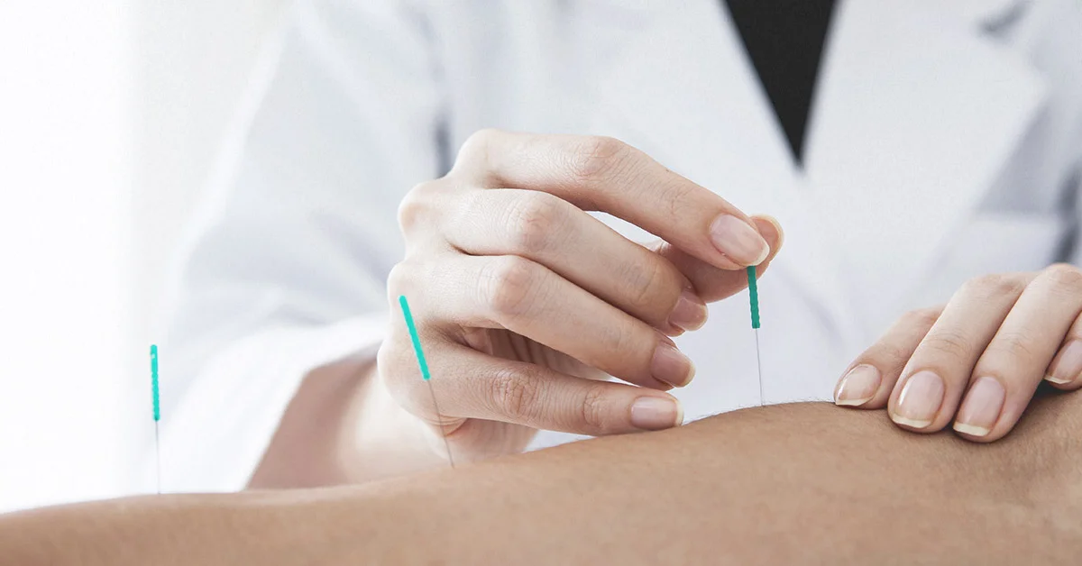 1200x628_FACEBOOK_-Dry_Needling_vs._Acupuncture_Which_Is_Right_for_You.jpg
