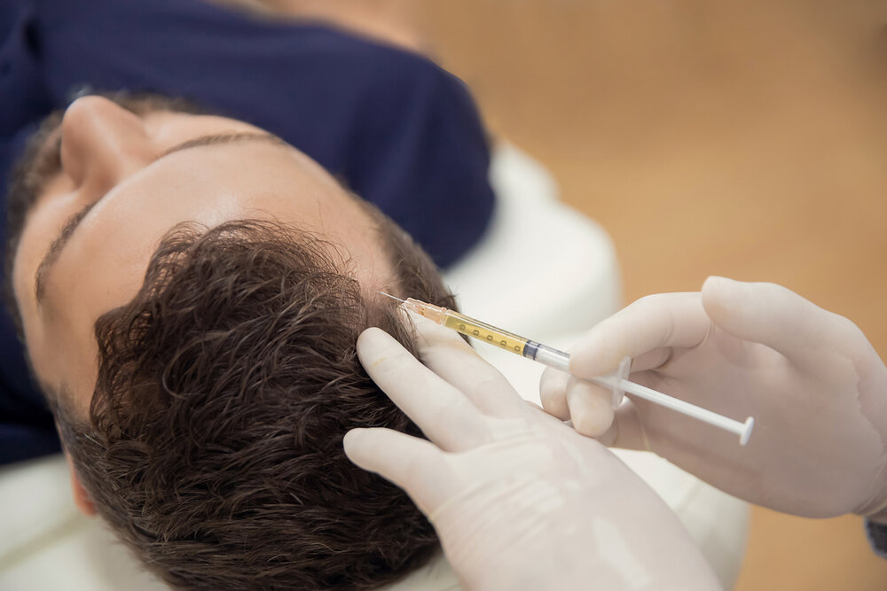 PRP - Platelet Rich Plasma - Hair & Cosmetic Indications — Dr John's Best Health PRP - Platelet Rich Plasma - Hair & Cosmetic Indications — Dr John's Best Health