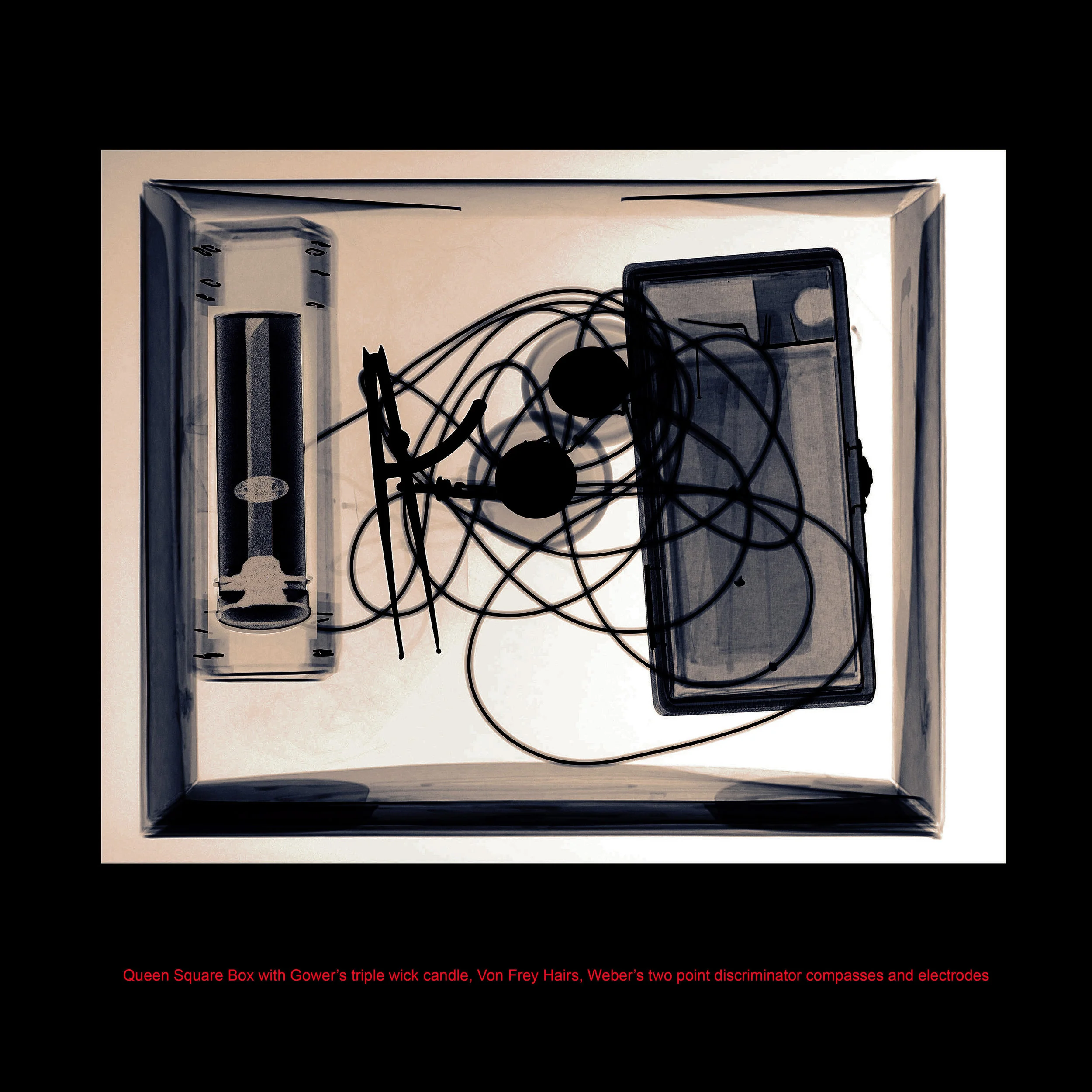 X-ray of objects from the Neurological Hospital Queen Square