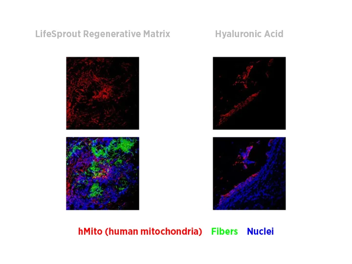 Survival of human adipose-derived stem cells is markedly greater in LifeSprout Regenerative Matrix than in hyaluronic acid hydrogels.